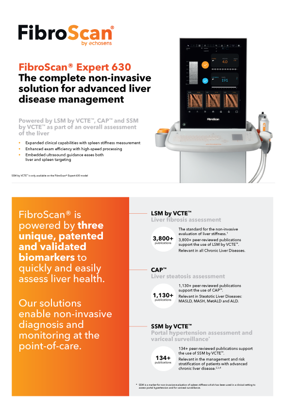FIBROSCAN ENG-30